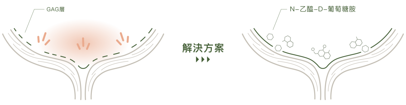 官網_Broadreach優抗官網介紹頁_1205_04_解決方案